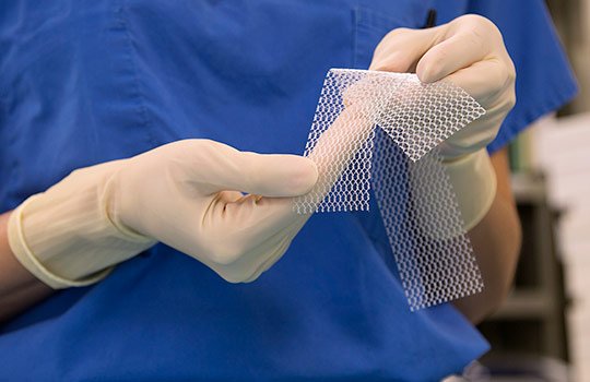 bmj_latest's tweet photo. Vaginal mesh: @JonathanGornall goes in search of the obstetrician who invented mesh and uncovers how the original evidence was mired in a multimillion pound deal, industry funded research, and undisclosed conflicts of interest https://t.co/t3vKqJ4axZ https://t.co/cU2K7Yv7Y1