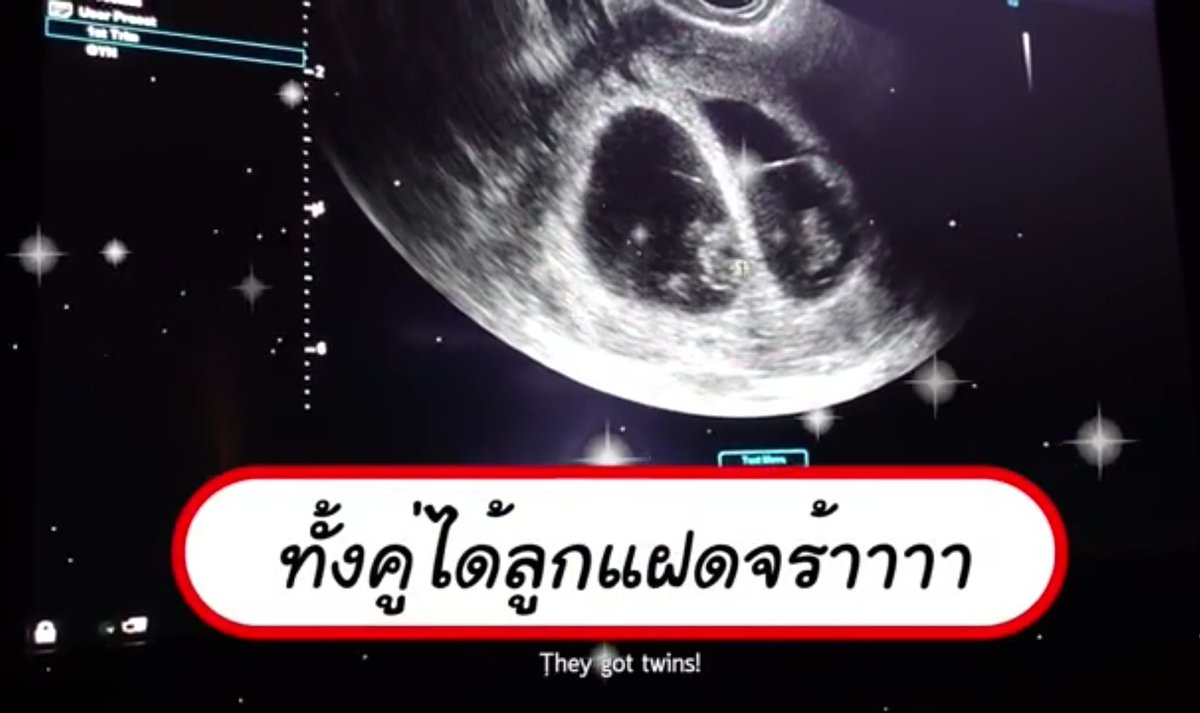UnderbedDara's tweet photo. ว่าที่พ่อแม่ลูกแฝดนาจาาาา

คอนแกรททั้งคู่อีกครั้งงงง จุดพลุ ปุ้งๆๆๆๆ

#ป๊อกมาร์กี้ #ใต้เตียงดารา https://t.co/o4Wyt43WCq