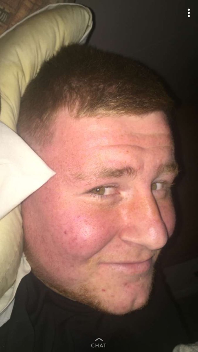 Joshconnelly00's tweet photo. Here if you ever think you’ve got a bad haircut just have a look at this you’ll feel much better a promise @KarlCharlton00 https://t.co/gpH4UAocGi