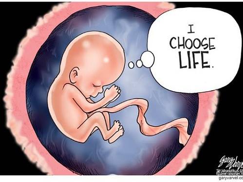 LiveAction's tweet image. I am a person

I have my own heartbeat

I have unique DNA and a perfectly formed, tiny body

I can feel pain, dream, and feel hunger

I am a human being, and I choose LIFE