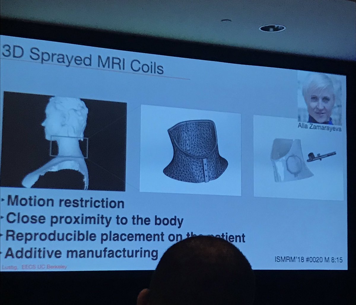 This was one of the coolest things I saw <a href="/SocPedRad/">The Society for Pediatric Radiology</a> Advanced Cardiac #imaging Conference. Miki Lustig <a href="/sm313/">Miki Lustig</a> showing ingenious methods for making pediatric #MRI coils. Better coill = better #CHD imaging 🙌🏽👊🏽. #GameChanger <a href="/3dheals/">3DHEALS</a> #WhyCMR #scmrchd