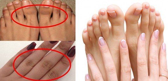 Behenapp's tweet photo. 4 easy remedies to get rid of dark finger joints
https://t.co/87BgPjTv9U https://t.co/LsGR6Vll9t