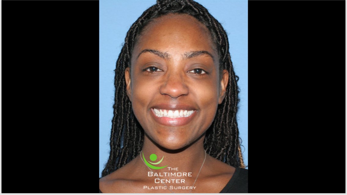 DrCapone's tweet photo. Facial tumors like this one are often devastating, even though benign and slow-growing. Removal risks include facial nerve injury, facial paralysis, and scarring. #TheBaltimoreCenter https://t.co/xUprvjKM51