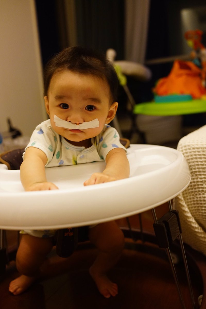 落合陽一さんが息子さんの口唇口蓋裂について生後まもなく公表 以降なぜ写真を撮ってsnsにあげるのかについて 当事者の救いになる と理由を語る Togetter 落合陽一さんが息子さんの口唇口蓋裂について生後まもなく公表 以降なぜ写真を撮ってsnsにあげるのかについて 当事者の救いになる と理由を語る Togetter