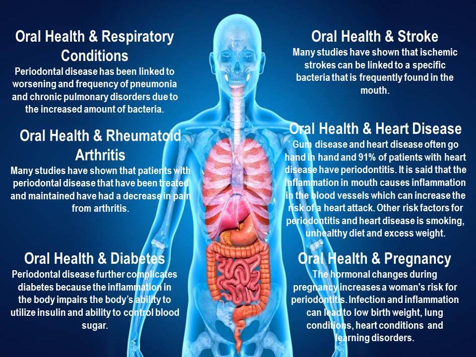 Dorothy Lane Dental on Twitter "There are so many systems & disease that have been linked