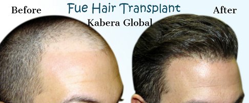 Kabera Global (@GlobalKabera) / Twitter Kabera Global (@GlobalKabera) / Twitter