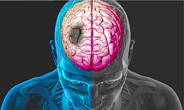 SkinOnlineBlog's tweet photo. Strokes can turn your world upside down in the blink of an eye. What causes strokes, what are the warning signs and what can you do to prevent them.
READ MORE: https://t.co/oe5mUBhuSp
#SkinOnline #SkinOnlineBlog #stroke #health #wellness #healthyliving #strokecauses https://t.co/TOeUTX7r5W