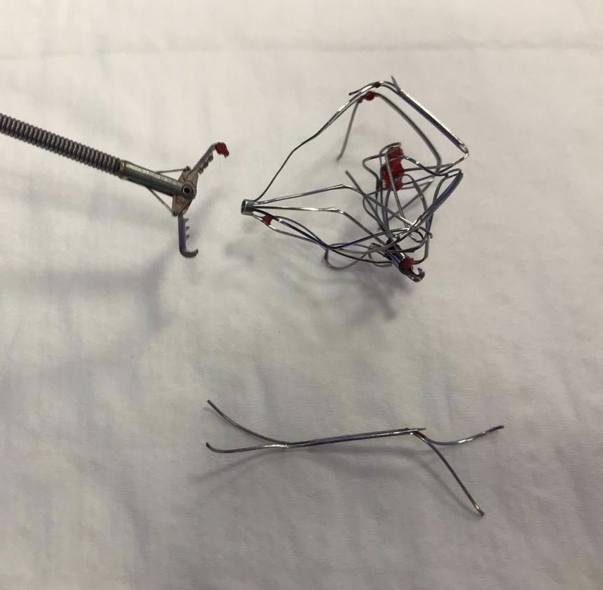 drmalshammari's tweet photo. Finally embedded and tilted #IVC filter came out by #IRads using forceps after been smashed #withoutascalple @JVIRmedia @SIRRFS @marabi2004 https://t.co/t2g8mPKD4t