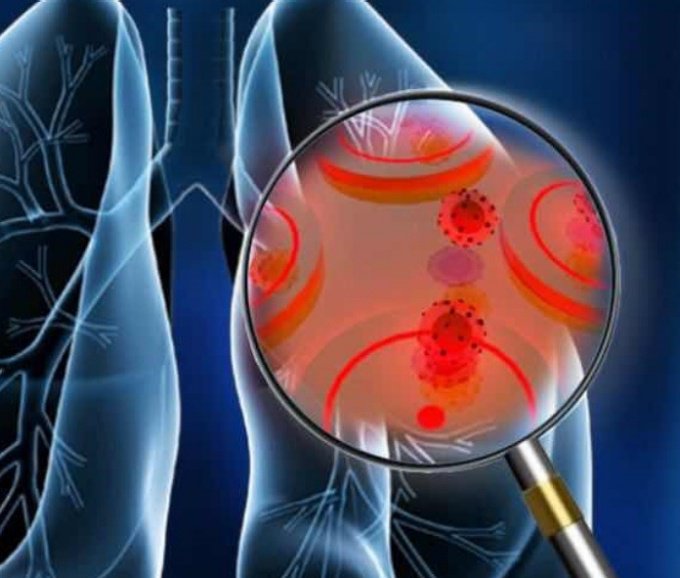 UBuffalo's tweet photo. Detecting cancer earlier 💙 #UBuffalo creating a new portable #cancer test that pairs with smartphones to detect the disease at an earlier stage and help those without easy access to care https://t.co/ypifLfYCc4 https://t.co/I8JQoJwoFx