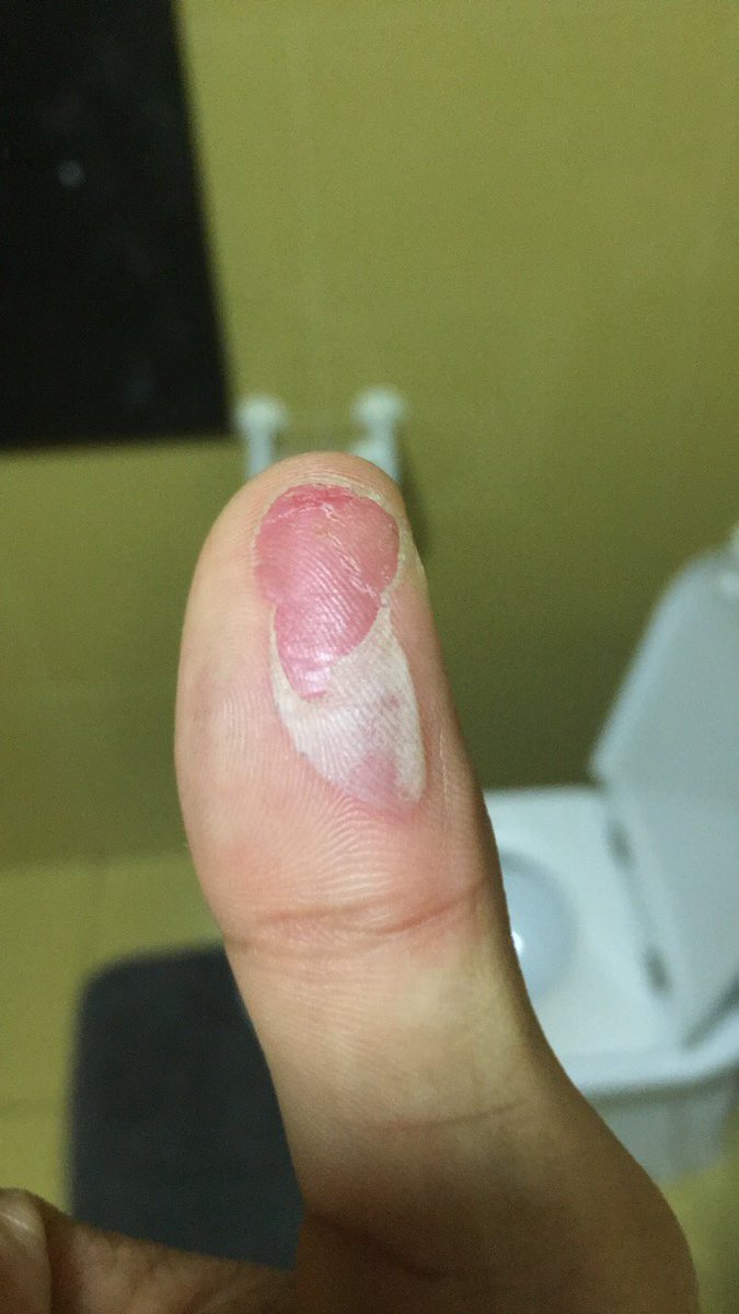 Saldanha ® tweet media