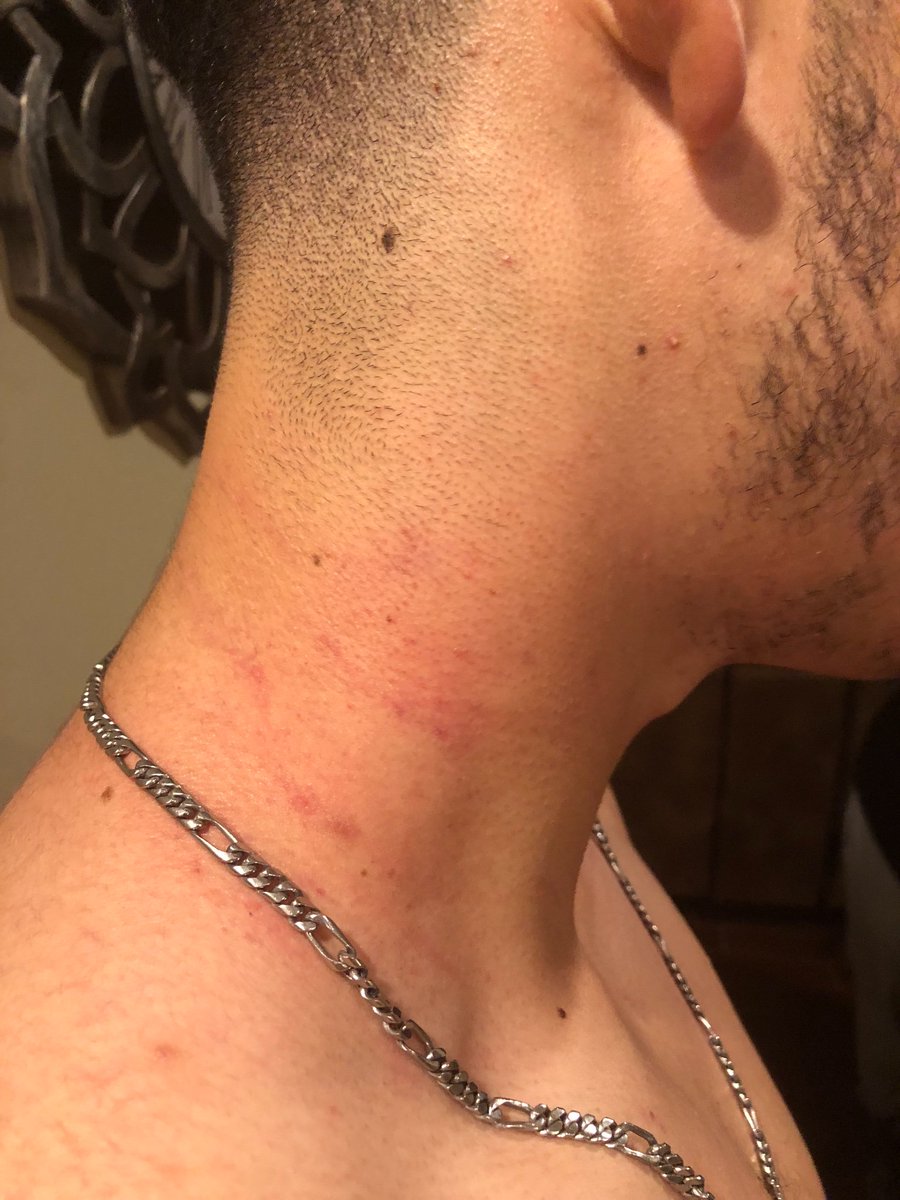 azalianani's tweet photo. A #Whitemale, off-duty #POLICE officer #assaulted my brother tonight. Cop came after my bro just b/c he was talking to the cop’s step-daughter. He bashed the car window, beat &amp; choked my bro to the ground. My bro DID NOT FIGHT BACK. The cop is home. No arrest. #NoJustice. https://t.co/0SRAieiG1U
