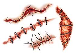 For a scary look this #Halloween #HalloweenSpooktacular - try some temporary tattoos for #stiches, #slashes and #scars with our gore and nightfall tattoos! sportsink.ie/en/temporary-t…