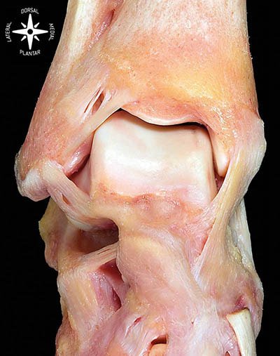 Visión antero-superior de la articulación TPA. Preciosidad obra del fallecido Dr. Pau Golanó