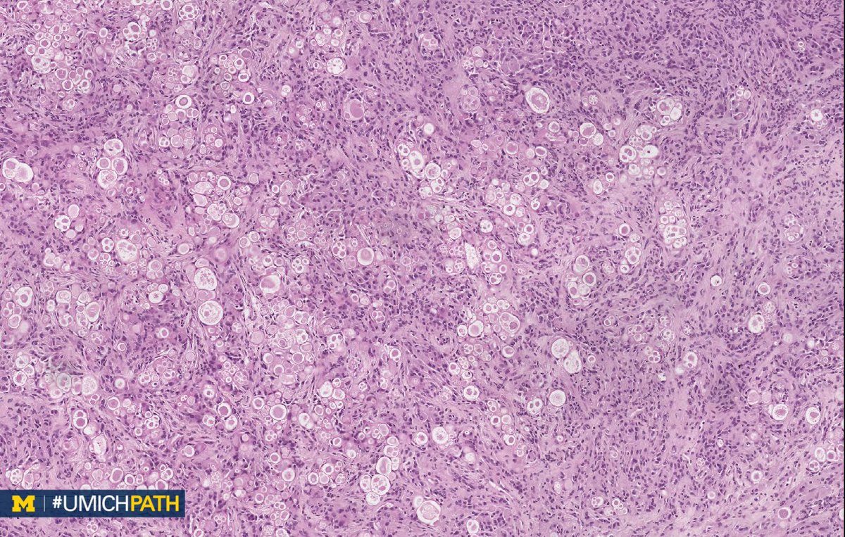 Michigan Pathology tweet media