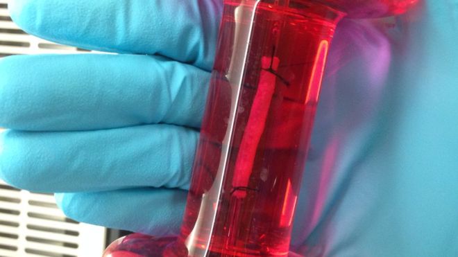 BBCFergusWalsh's tweet photo. Scientists create oesophagus in the laboratory - pioneering research at @GreatOrmondSt  @TheCrick  @UCLchildhealth - my report on #bbcnewssix   https://t.co/zun3w7B4Nx https://t.co/LNkHraI1mu