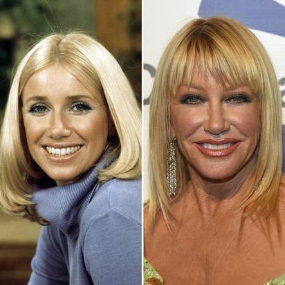 Happy 72nd Birthday to Suzanne Somers! The actress who played Chrissy Snow in Three s Company. 