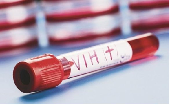 El_Universal_Mx's tweet photo. #Entérate Eliminan VIH en seis pacientes con trasplante de células madre https://t.co/ZfPwg9asW5 https://t.co/22fCs4mKBH
