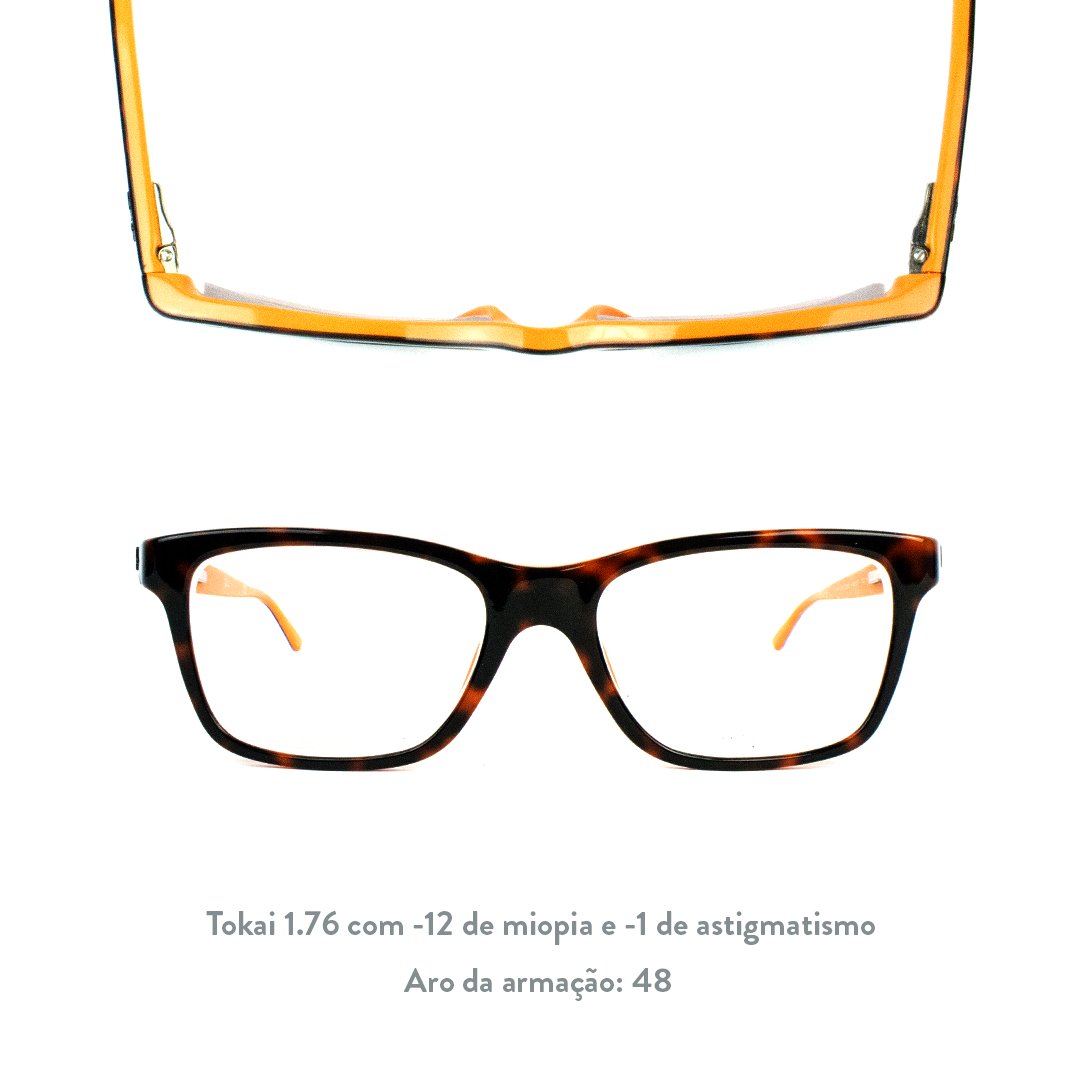 lenscope's tweet photo. Você sabia que as armações feitas de acetato fazem um par perfeito com as lentes Tokai 1.76? Elas ajudam a disfarçar as bordas das lentes de alta miopia 😍#lenscope #oculos #altamiopia #miopia #visao #tokai1.76 https://t.co/GN6oD5WIOx