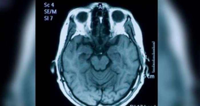Bilim İnsanları Onayladı: Unutkanlık Aslında Zeki Olduğunuzun Belirtisi.

Zeki insanların beyinleri, uzun vadede işlerine yaramayacak bilgiyi hafızadan silerek çalışır.

Bu haber iyi geldi:)