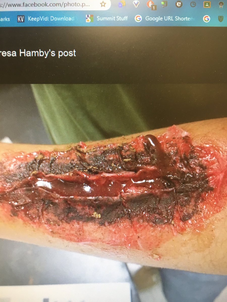 KristiBarber12's tweet photo. PDHS Anatomy class learning about body system interactions with wounds, burns, and wound care!  Disclaimer: students created their fake wounds! @PaloDuroHS @ccki #realworldscience https://t.co/slQYulXsDK