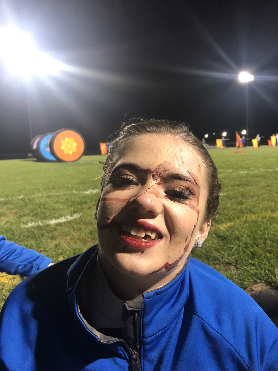 KaleyGilland's tweet photo. I hope you all have a new found respect for what I and my friends do as a part of color guard. There is so much more than just ”flag twirling”. I chipped 2 teeth and got 4 stitches all in one practice. Take some time to appreciate the art that we put on. ❤️ https://t.co/QkNvQSCWto