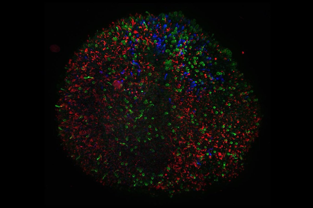 LisaB_Optometry's tweet image. washingtonpost.com/science/2018/1…