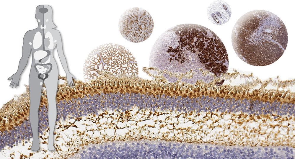 New Tissue Atlas publication on proteins expressed in specialized tissues. ow.ly/uxIB50jqPKb
#HumanProteinAtlas #missingproteins <a href="/JProteomeRes/">Journal of Proteome Research</a>