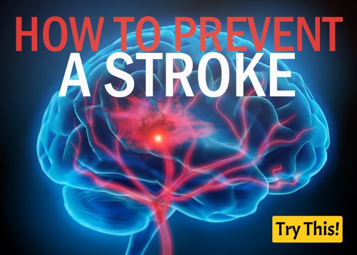 TryThisDotCo's tweet photo. 10 Best Ways to Prevent a Stroke
#trythis #healthylivingtips #healthylife #strokeremedy #nomoreheartattacks #stroke #cardiohealth #howtoprevent #protectyourheart #increasenitricoxide #hypertention #antihypertention #antiatherosclerosis #braincells #neuro
https://t.co/X5H8X8I4Lz https://t.co/eExVEi4ZUz