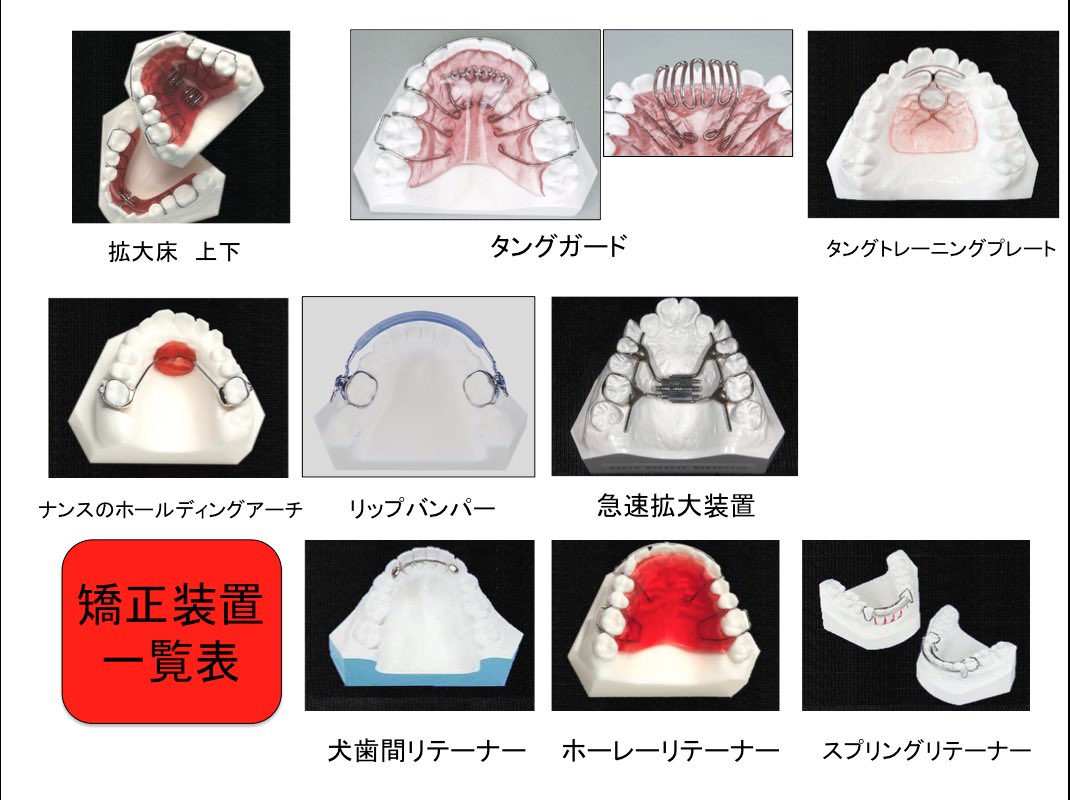 歯科医師のための一問一答 矯正装置一覧 1