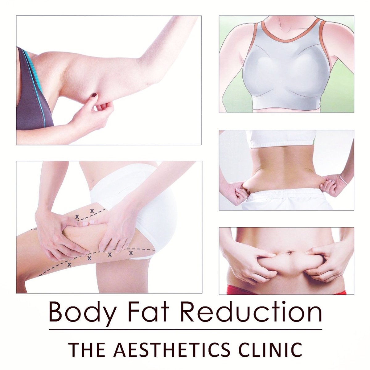 SLACPK's tweet photo. Get rid of stubborn fat #Belly #LoveHandles #Thighs #Arms #DoubleChin #Abdomen #HeavyBreasts
The Aesthetics Clinic - Dr. Shaista Lodhi.
For details and appointments call: 0321-1225719 021-38883275 DHA - Karachi.
#DrShaistaLodhi #ShaistaLodhi @IamShaistaLodhi https://t.co/gGiAaV437z