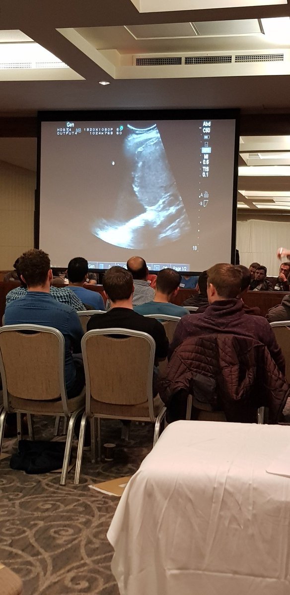 a_goatlet's tweet photo. And it wouldn't be a #POCUS course without @POCUSClub - pleural and pericardial effusions on #POCUS really simple to see and quite groovy too. https://t.co/szi4QmWzt5