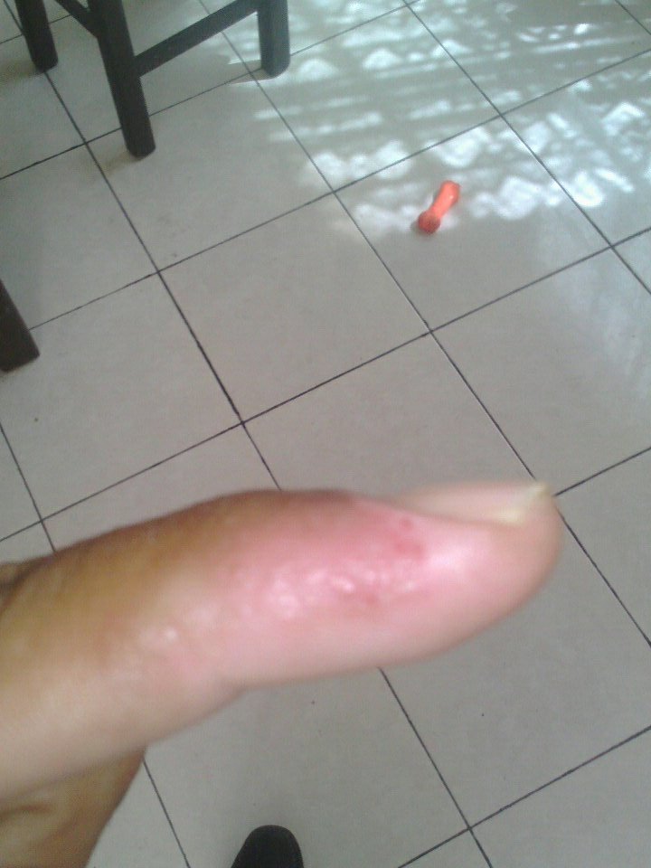 IvanAlmazn1's tweet photo. ...2/2 pero es debajo de la piel eso es normal de antemano nunca e tomado su curso por que no. allegado a nuestro estado solo por vídeos y entrevista esta es la imagen de las burbujas de antemano gracias https://t.co/tsJMz3ui1Q