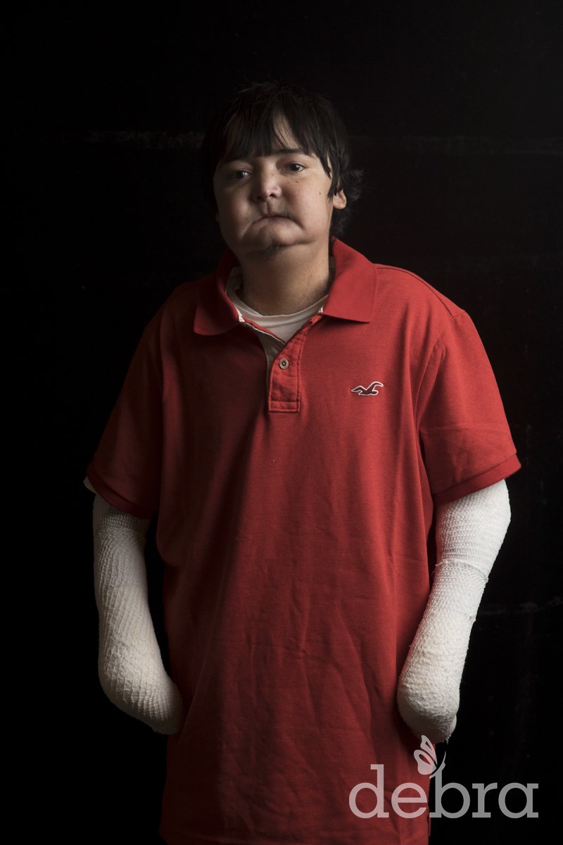 debraOfAmerica's tweet photo. "The fact that I was the Valedictorian of my graduating class... is very shocking to people because once they see me they assume that I have something going on with my brain." Read more + share Julio's #EverydayEB story in honor of #EBweek: https://t.co/zCRLwKAiRB https://t.co/gGO4TRhagX