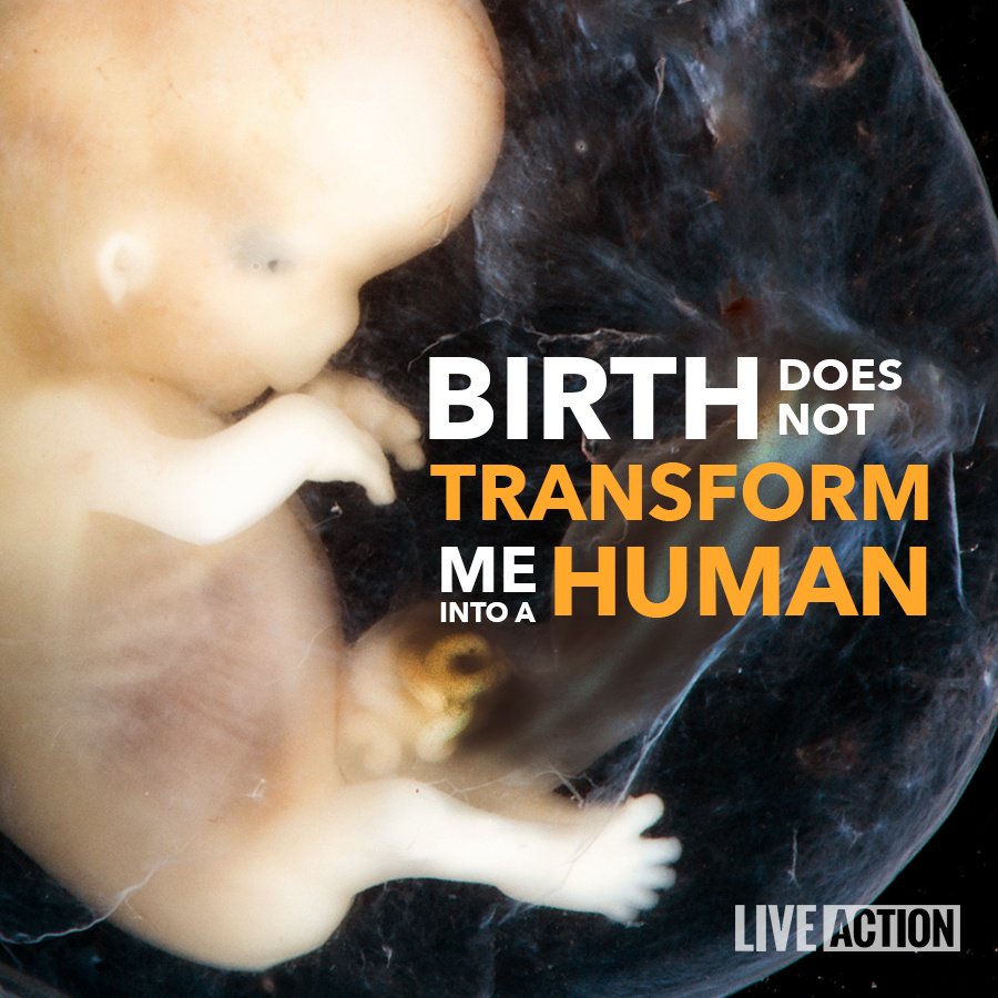 Image result for a fetus is a human being pictures