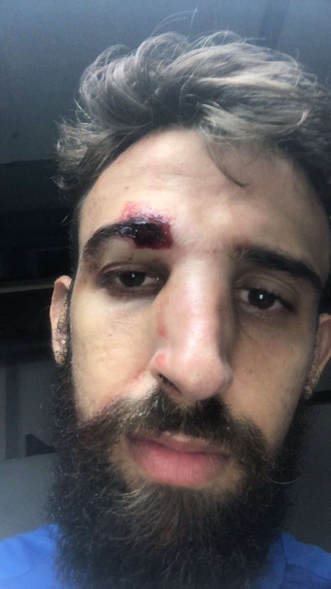 sparla4's tweet photo. Enhorabuena @uesantandreu disfrutar de un premio que quizás si hubiese arbitrado alguien valiente, hubiésemos disfrutado nosotros. Pido disculpas a nuestra afición por los últimos resultados, os necesitamos más que nunca, ojalá el domingo sigáis dejándoos la voz por nosotros ❤️💙 https://t.co/tg3txvst4T