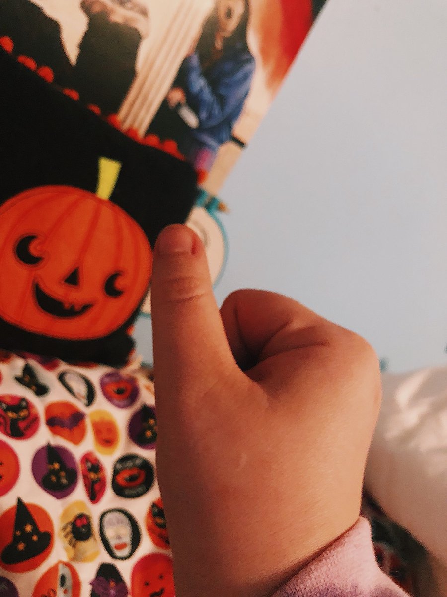 hall0wqueeen's tweet photo. #MyFirstTimeWithMichaelMyers - I was seven & ended up being scratched by a cat after watching it which resulted in this lil scar which always reminds me that Halloween is literally a part of me @halloweenmovie #Halloween2018 https://t.co/lALM3wzbmL
