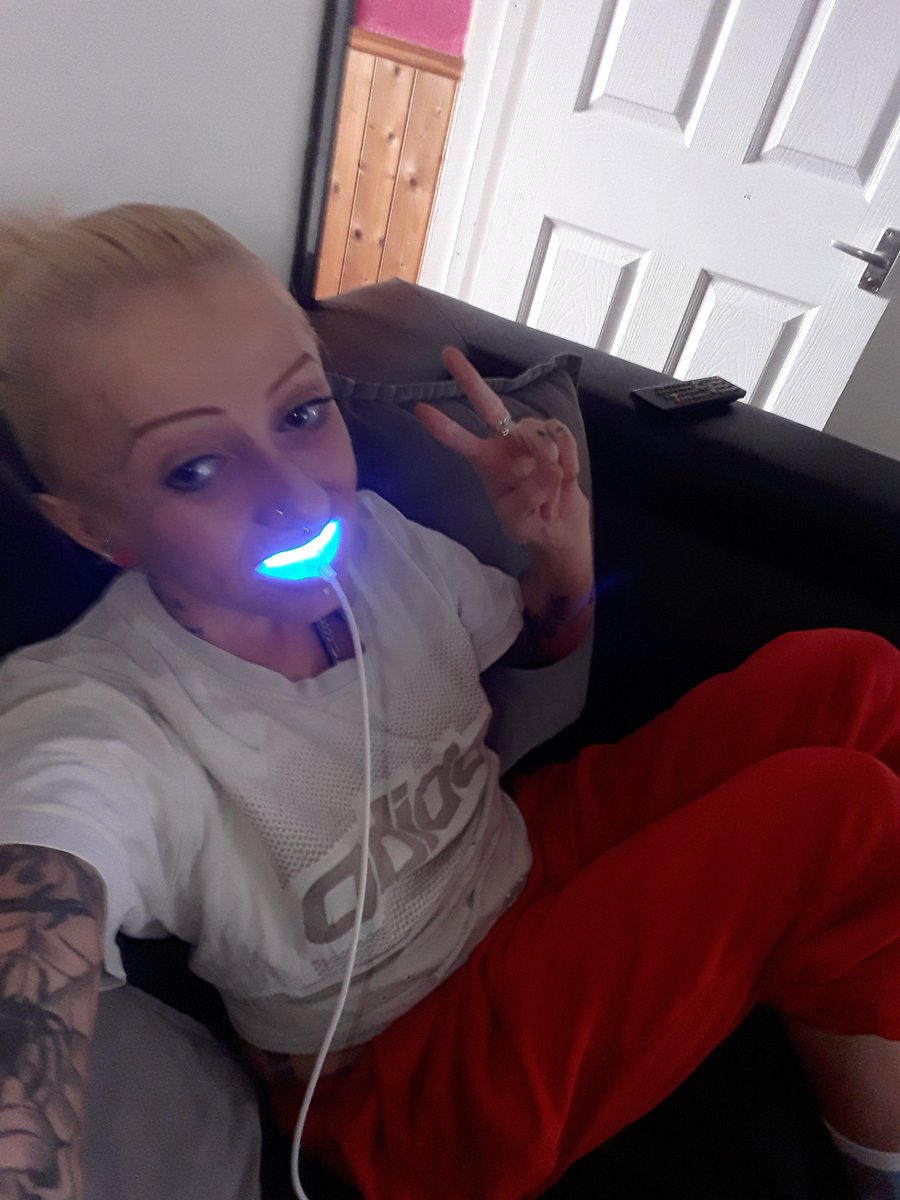 pinkster666's tweet photo. #bleachingteeth https://t.co/a3D2o4fxNl