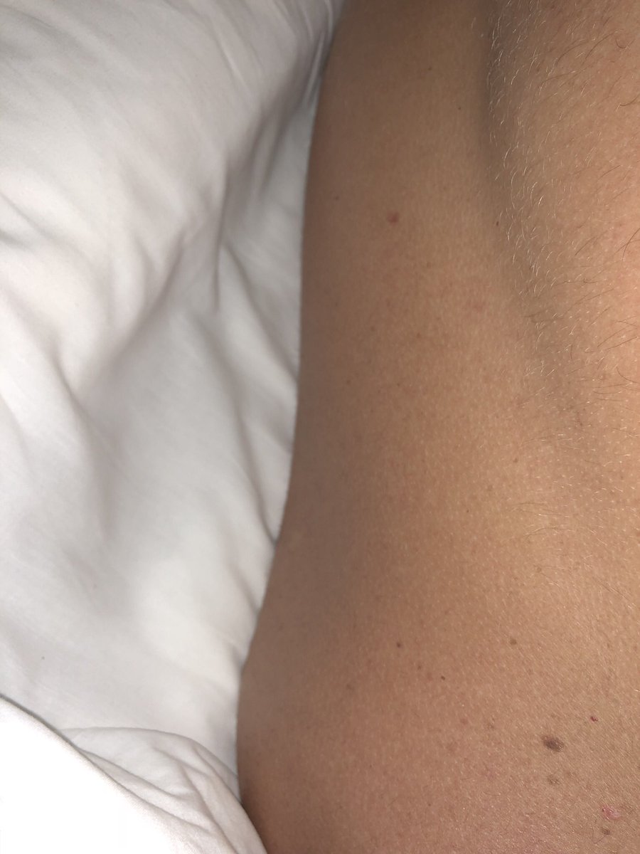 chloemharris's tweet photo. @TUIUKcares @TUIUK this is Tui’s idea of a 5* hotel?! Look at the difference in the bed heights!! Plus they booked it via telephone for us and booked a “twin” for me and my fiancé! Now said we booked it wrong!!!! Wow! And they now ignore me and “close” our case I don’t think so! https://t.co/F6ULmSnQBw