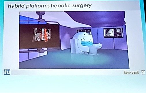 acteursdesante's tweet photo. #BIGBANGSANTE La chirurgie assistée par ordinateur, témoignage sur les nombreuses innovations technologiques (scanner, #Robot, #VR, #IA...) par le Dr Jacques Marescaux @JMarescauxIrcad @IrcadFrance #esante #IA #vr #innovation #hcsmeufr #watsonIBM https://t.co/SRUthP5jrK