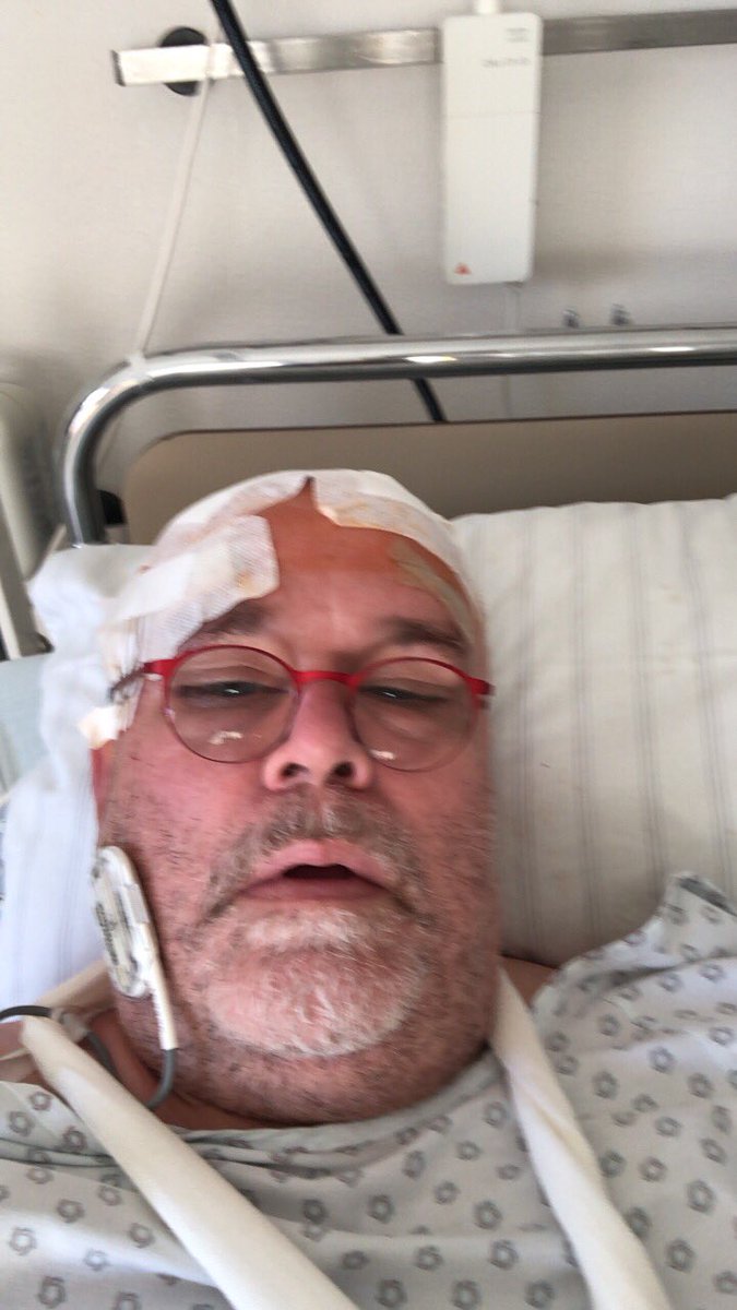 TheRealPeterS1's tweet photo. Quick update, Op done, meanwhile I have my mobile back after 24 hours, Op went very well, now my device is being tested and after that it will be implanted in a second, much shorter op. Thumbs up so far !!! https://t.co/2TOy6GCHNG