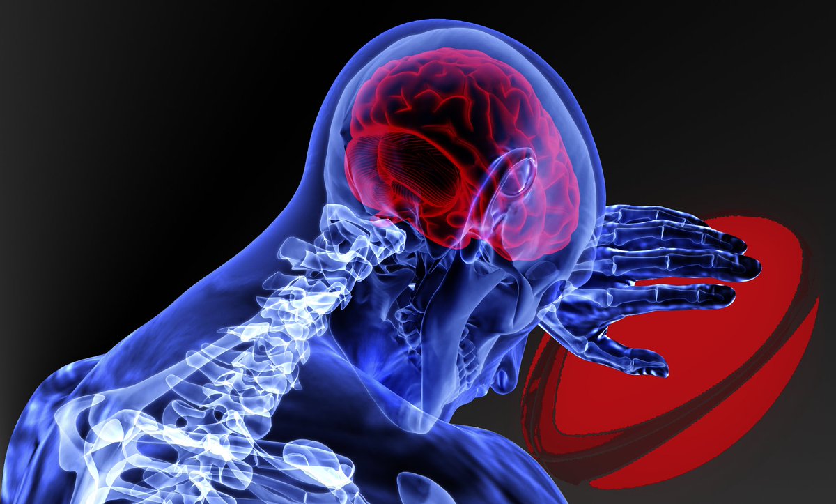 MorganSportsLaw's tweet photo. Brain Injuries in Sport – @MSL_Henry examines the legal framework in England &amp; Wales: https://t.co/1Qjbpu9KFr https://t.co/9QNbXsxJoD