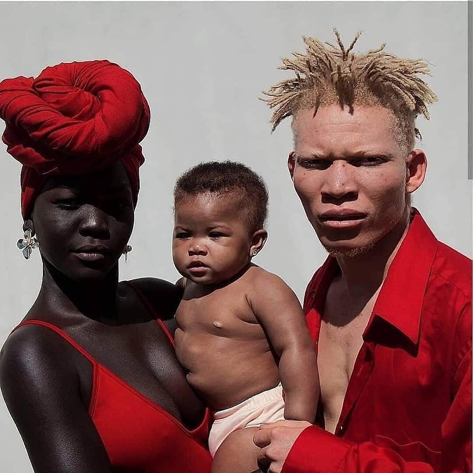 AlbinismSA's tweet photo. "A family is like a forest,when you're outside it is dense, but when you're inside you see that each tree has it's place" #shadesofblack #blackfamilies #albinismisbeautiful 
Images by : @iamafropolitan https://t.co/K7Ou0ZT104
