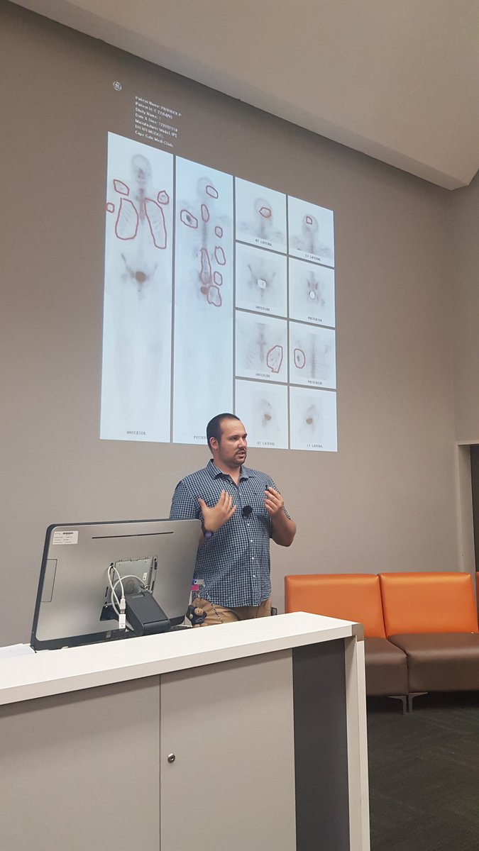 WrapItUpComms's tweet photo. @PhilParrock sharing how he found out he had Non-Hodgkins Lymphoma and the road to recovery @SU_Alumni #SUCareersCafe @StellenboschUni https://t.co/j2SM3CYuZs