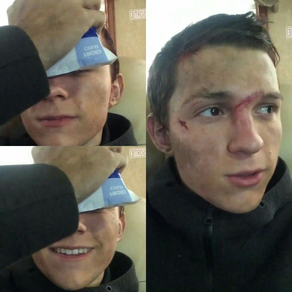 ToddHewLIT's tweet photo. Y'ALL i was on the way to the swamp today and of course i run into effing Aaron (the "noble preist" of Prentisstown 🙄)  and he effing smacks me in the face. his ring ripped open my lip and i probably have a broken nose now 😩 https://t.co/RvL6qRRKoT