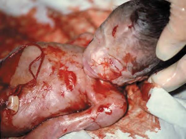 OfficerWally's tweet photo. @Seabeacon7 @FidoSysop YOU ARE ACTUALLY THE "POOR THING" WHEN YOU SUPPORT KILLING BLACK BABIES WITH #ABORTION.
And your Murderous #SocialistDemocrat friends are racist.
#BillNelson
#AndrewGillum
#TracyePolson
#JonTester
#ClaireMcCaskill
#KyrstenSinema
#JackyRosen
#SeanShaw
#SenatorBillNelson
#SeanShaw https://t.co/dc35XC06Ku