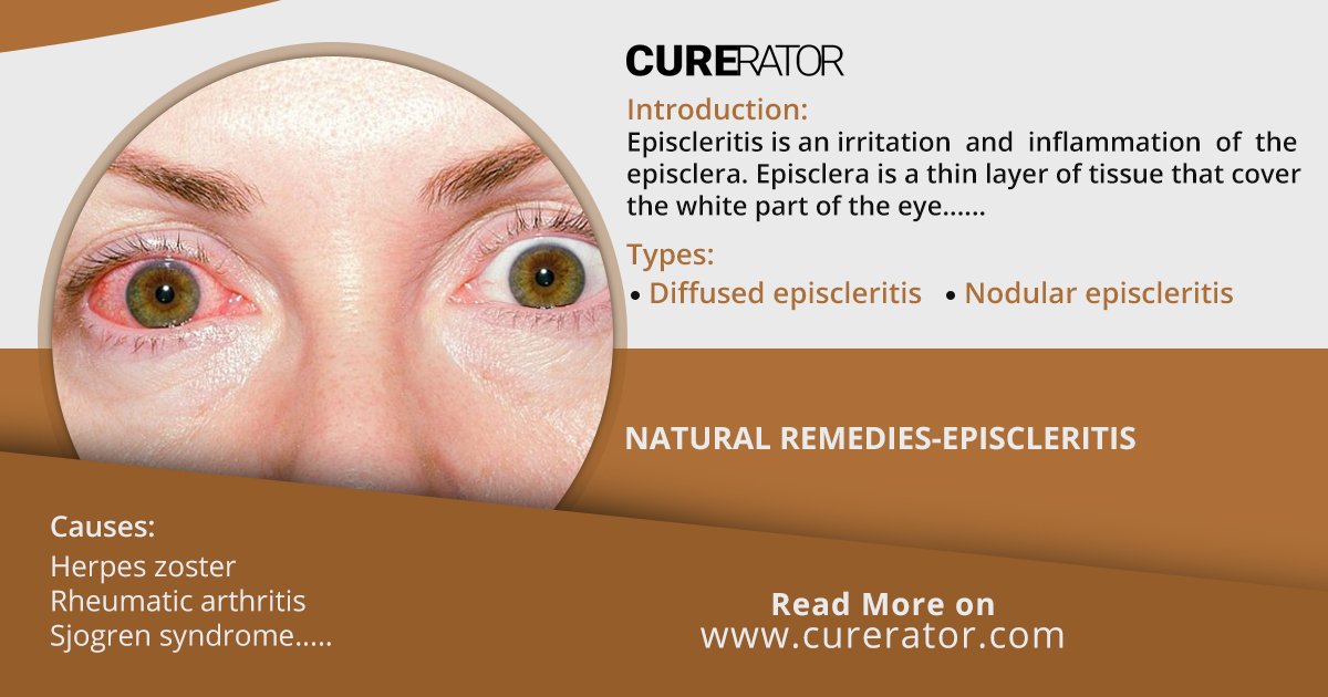 Curerator1's tweet photo. For every #health_problem, there is a #natural_remedy. The best #natural_remedies for #health and #fitness problems are accessible on this remarkable platform. https://t.co/tgCA1mcOOP