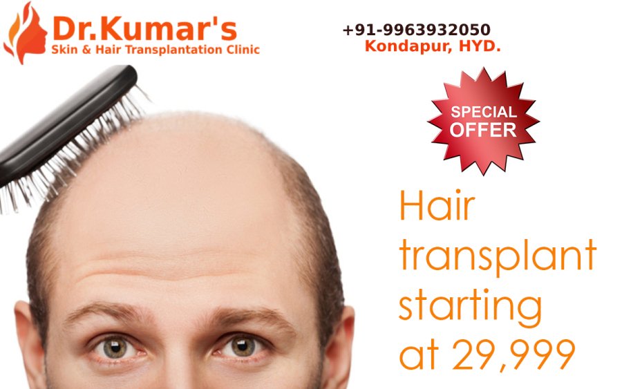 drashokkumar143's tweet image. Hair Transplants treatment starting from 29,999 Available for Dr.Kumar&apos;s Hair Transplantation Clinic
thehaircare.co.in
#Hair_Transplantation_in_Hyderabad
#Hair_Transplants
#Hair_Transplant_in_Hyderabad