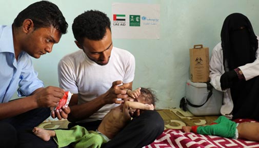 UNICEF's tweet image. In response to severe acute malnutrition cases, @UNICEF_Yemen is on the ground with several mobile clinics delivering lifesaving nutrition services to children and their families.

#ChildrenUnderAttack