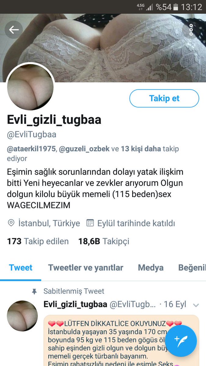 Arkadaşlar bu saydam çalındı bilginize bakıyorum paylaşım yapılmıyor ışte böyle götlerde  var amk  çocuğu