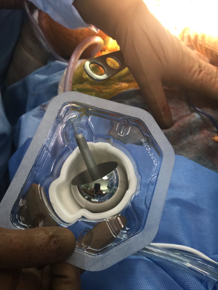 caderarodilla's tweet photo. #HipResurfacing #BHR

De vuelta en #México

Excelente alternativa en pacientes jóvenes, activos y deportistas

#HipTeam

https://t.co/uHBM4TFgEX https://t.co/qt61N90v6R